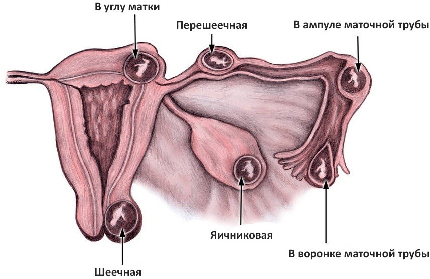 ТЕЧЕНИЕ БЕРЕМЕННОСТИ ПО НЕДЕЛЯМ