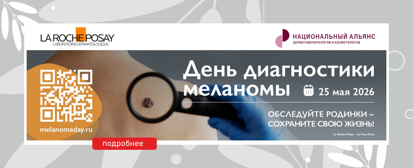 Меланома
