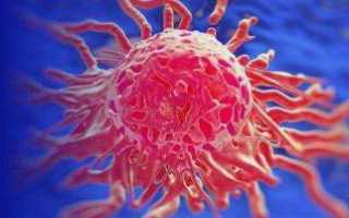 Об онкомаркере cyfra 21 1 &ndash; расшифровка и норма