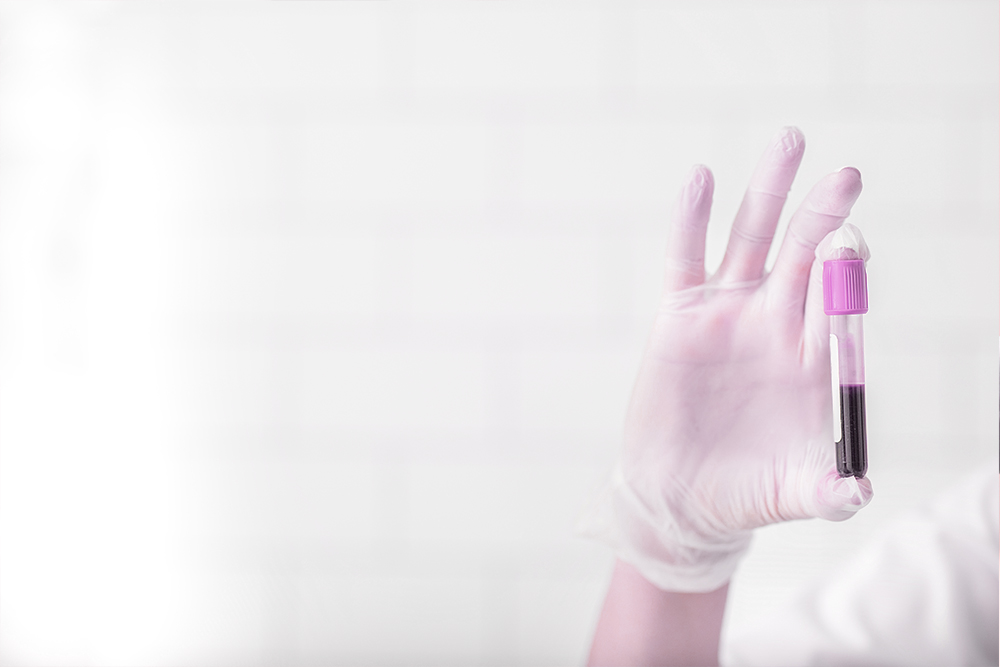 АТ-МАГ (антитела к микросомальной фракции тироцитов, АМАТ, антимикросомальные) – цена, сдать в Москве