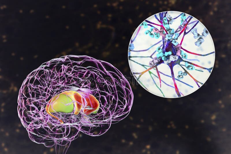 антибазальные ганглии антитела 3d концептуальная иллюстрация Иллюстрация  штока - иллюстрации насчитывающей ганглии, медицинско: 218039846