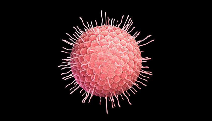 Опоясывающий лишай (опоясывающий герпес) - симптомы и лечение