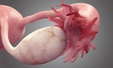 Онкомаркер СА 125 оказался более информативным скрининговым тестом, чем  считалось ранее | Новости | &laquo;Лечащий врач&raquo; &ndash; профессиональное медицинское  издание для врачей. Научные статьи.