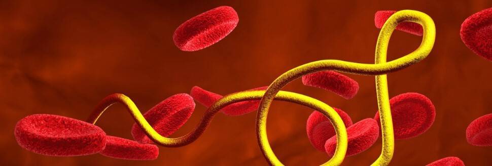 Анализ АТ к возбудителю боррелиоза IgG (с определением титра) на Ленинском  проспекте, цена, запись