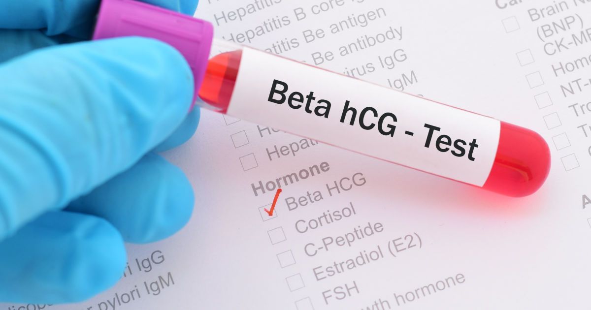Когда нужен анализ крови на ХГЧ? - Клиника &laquo;9 месяцев&raquo;