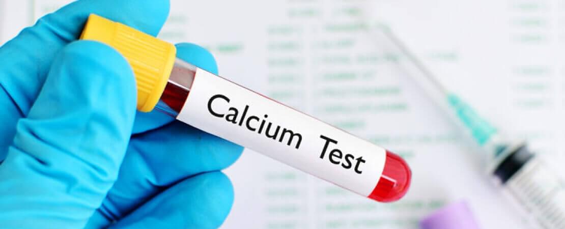 Кальций общий &mdash; Медицинский центр в Махачкале &laquo;Целитель&raquo;