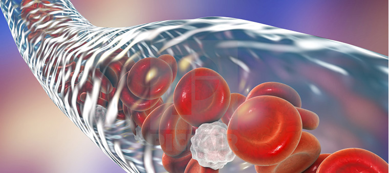 ГОМОЦИСТЕИН - АМИНОКИСЛОТА, ПОВРЕЖДАЮЩАЯ СОСУДЫ