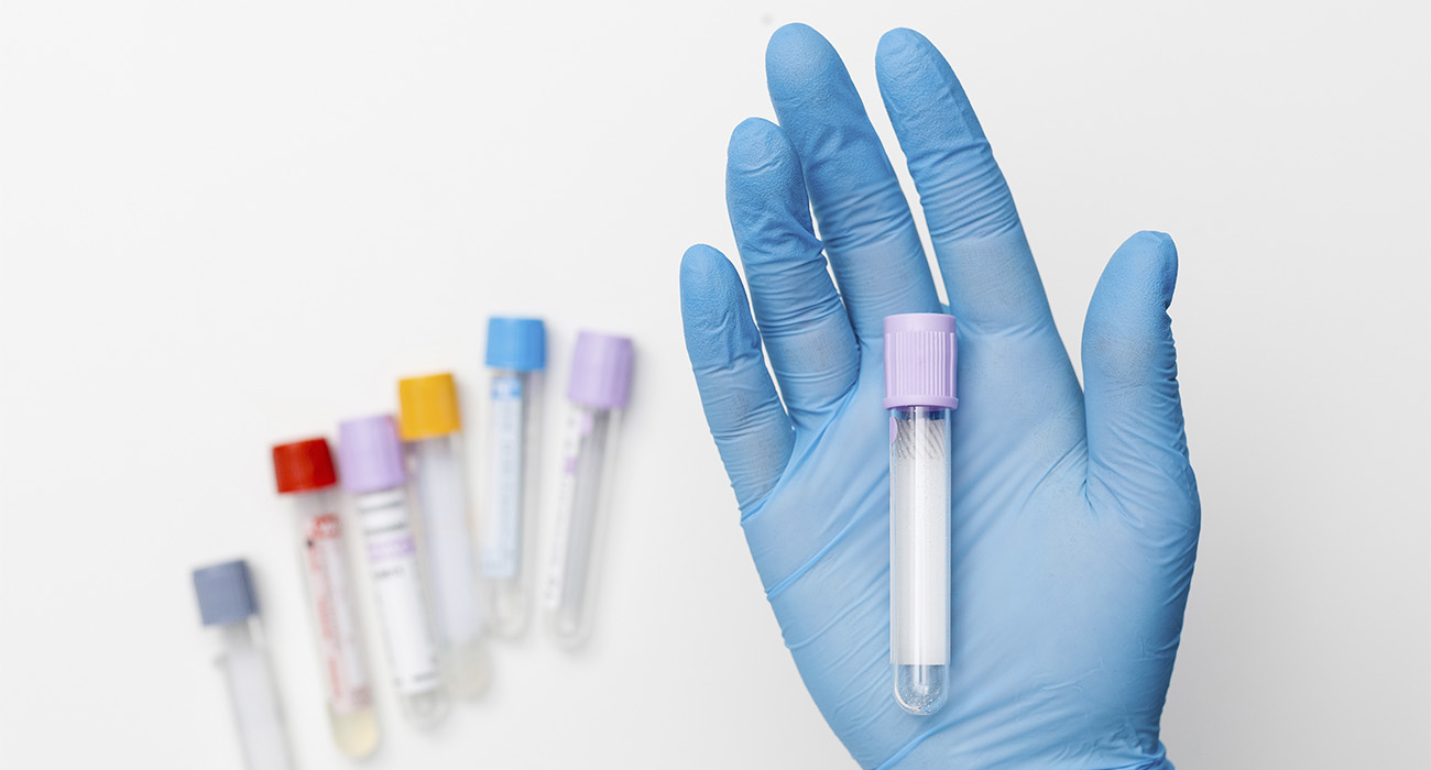 Онкомаркер Са 19-9: что показывает, норма у мужчин и женщин