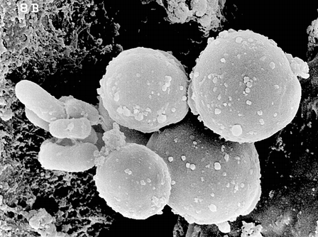 Кандида (Candida albicans) (определение ДНК), (качеств.)
