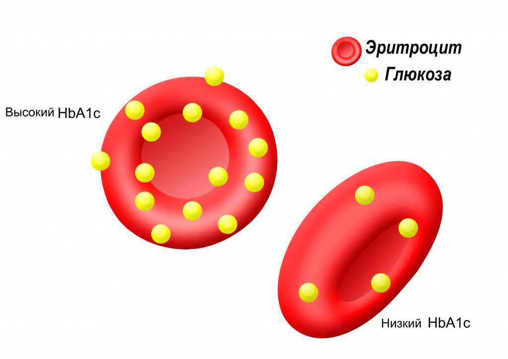 Гликированный гемоглобин (HbA1С, Glycated Hemoglobin), правила подготовки к сдаче анализа, расшифровка результатов и показатели нормы.