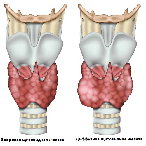Антитела к тиреоглобулину, показания к назначению, правила подготовки к  сдаче анализа, расшифровка результатов и показатели нормы.