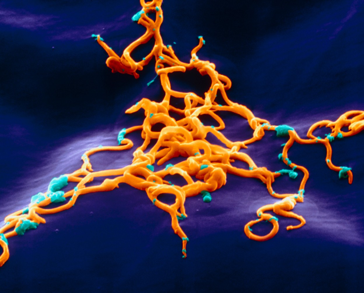 Биологи выяснили, как возбудитель боррелиоза обманывает иммунитет