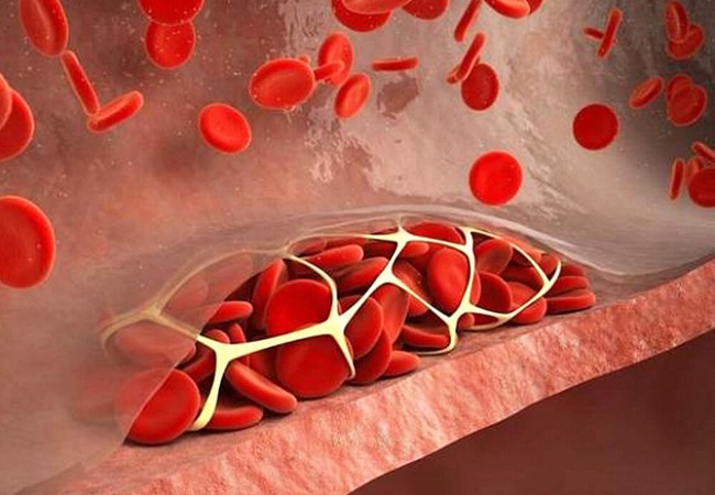 Исследование на генетический риск развития тромбофилии в ООО Медицина