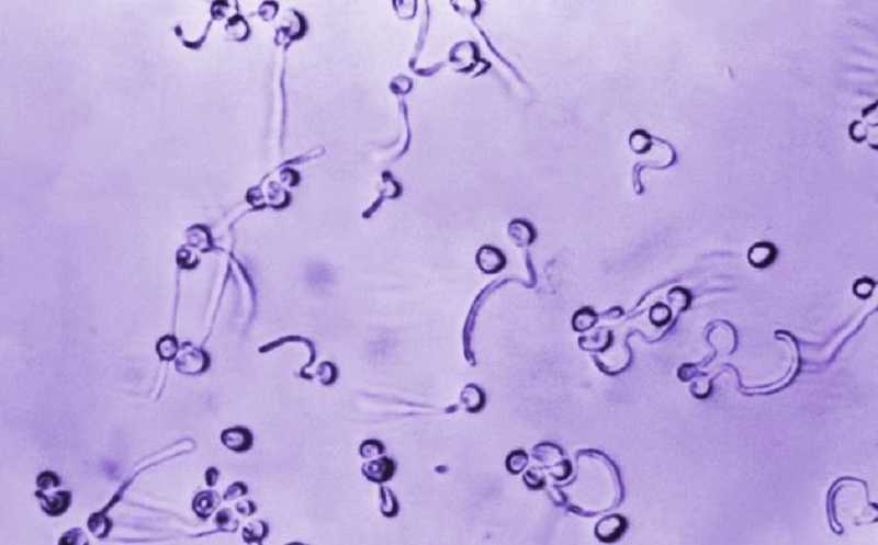 Российский ПЦР-тест выявляет пять возбудителей поверхностных микозов с  высокой чувствительностью &mdash; PCR News