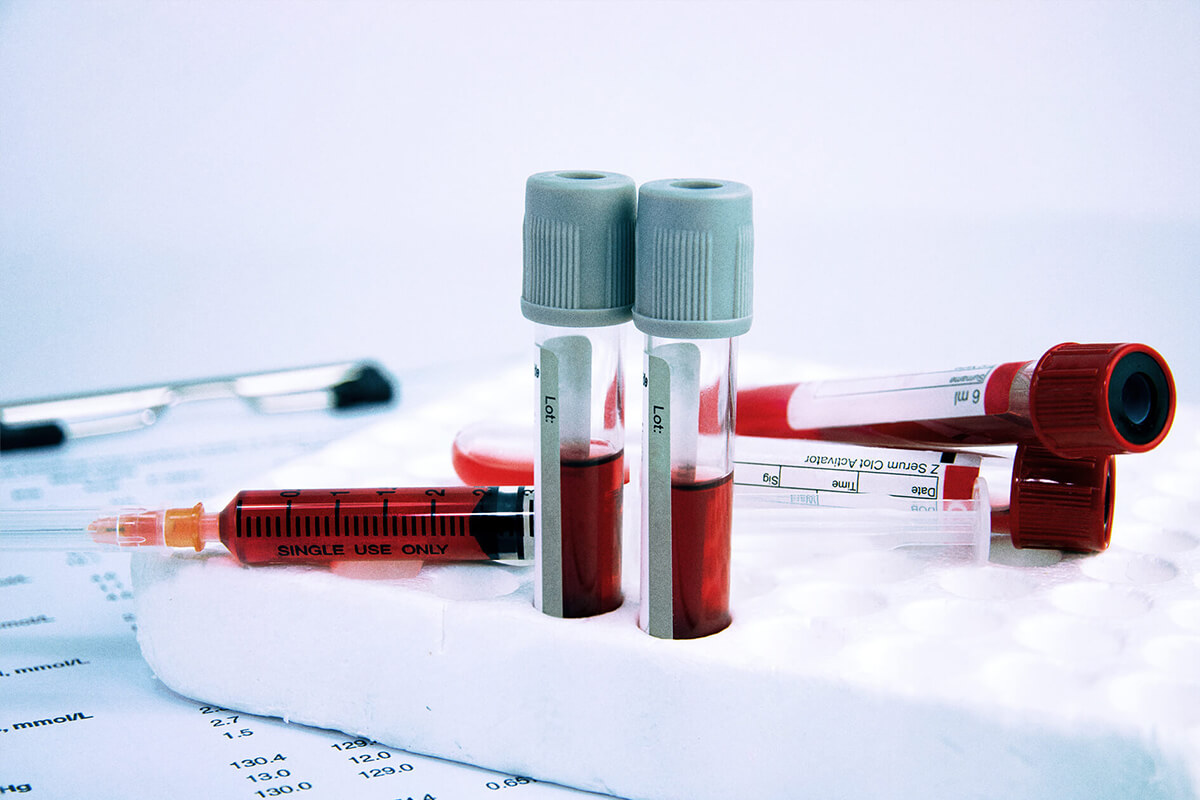 Ovarian Cancer - Basic Science Perspective