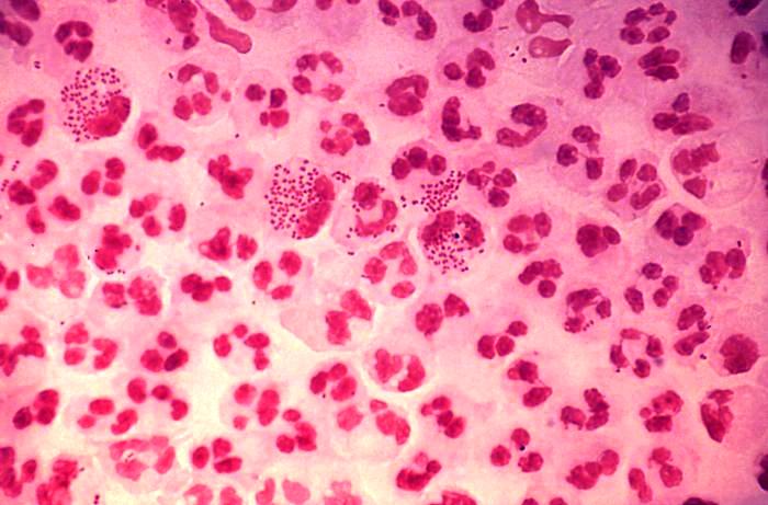 Нейссерия гонорея (Neisseria gonorrhoeae) (определение ДНК), (качеств.)