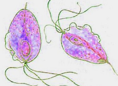 Сдать анализ на выявление трихомониаза (Trichomonas vaginalis) в Челябинске