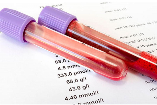 Биохимическое исследование крови. Подготовка, расшифровка, стоимость